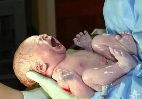 杀不死的婴儿:宝宝出生手握避孕环_大燕网河北