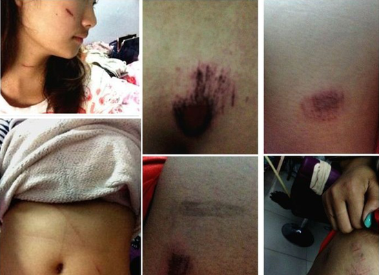 20岁少女在酒吧门口被多人围殴扒内裤 寻目击者