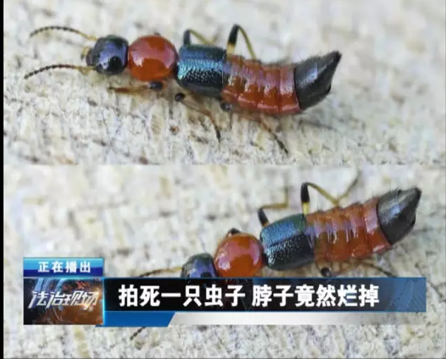 男子一巴掌拍死一只虫 导致半个脖子烂掉