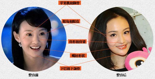 网曝郑爽整容前生活照称不会考虑再整容_大豫