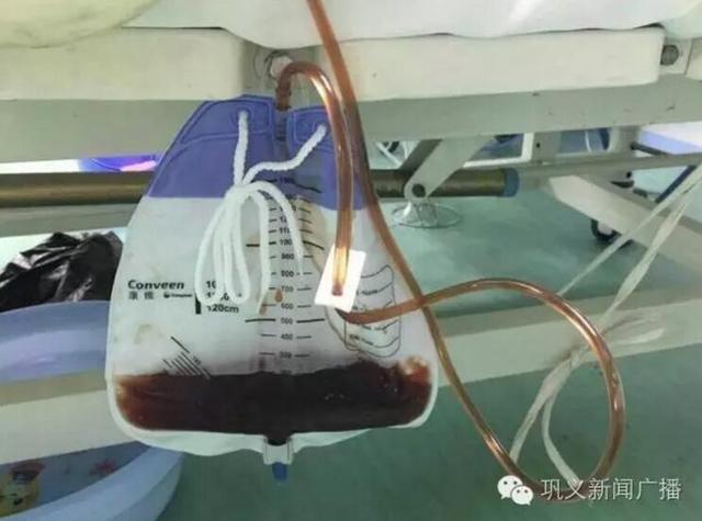 巩义老人上山摘枣被毒蜂蛰死 透析尿液呈现红