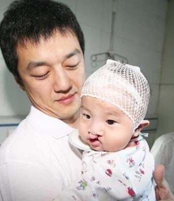 嫣然天使+首个儿童慈善医院救治兔宝宝