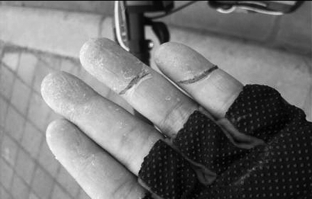 市民遭风筝线拦路“暗算” 网友：莫随意丢弃