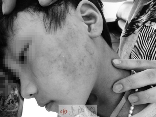 10岁女童疯狂向同学施暴 强迫吞唾液舔脚趾