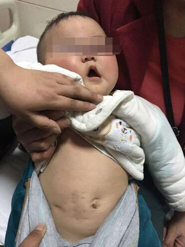 漯河聋哑夫妻生下男婴 十个月大就被查出三种