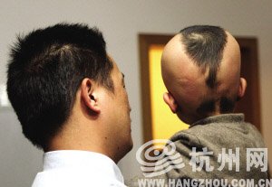 16个月大<em>男婴</em>患恶性脑癌经6次手术30次放疗治