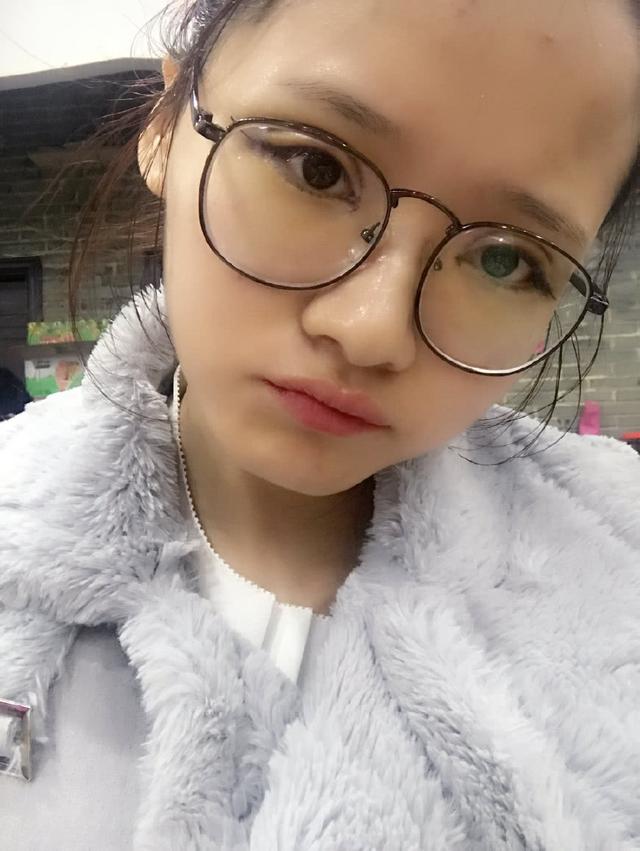 美吧美啦案例:女主播做双眼皮手术,卸妆对比照