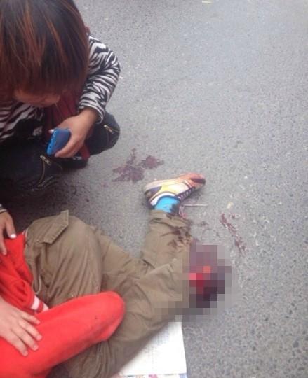 郑州一小学生脚被公交车碾压 躺在地上脸色苍