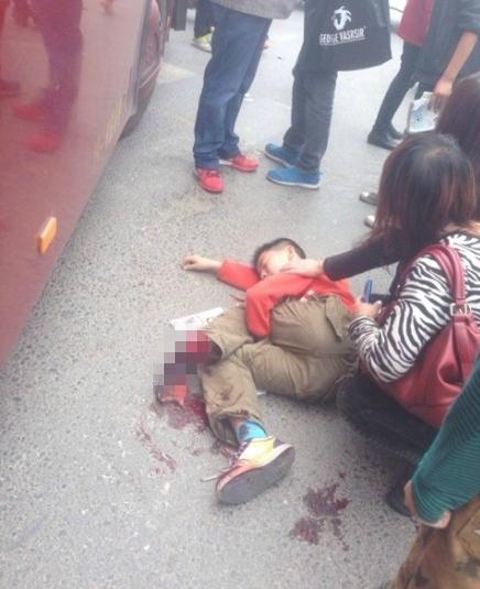 郑州一小学生脚被公交车碾压 躺在地上脸色苍