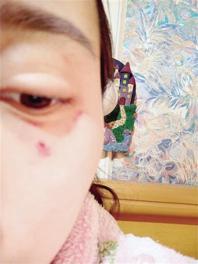 郑州女子网购投诉遭卖家千里追打 警方已介入调查