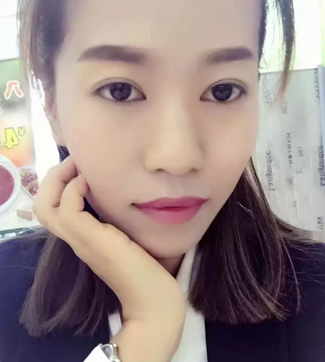 【大豫爱眼团案例】美女经理自述近视手术 术中25秒后