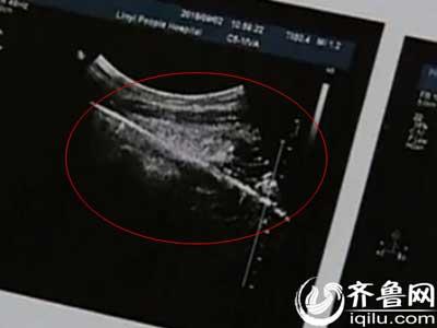 【花椒面】:智障女,谁来保护你?