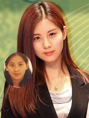 少女时代整容前后对比照