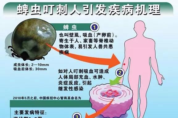 春季踏青草地游玩警惕蜱虫叮咬 严重可能致死