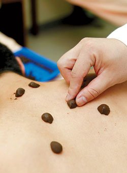 冬病夏治贴三伏贴讲究多:要贴够三年