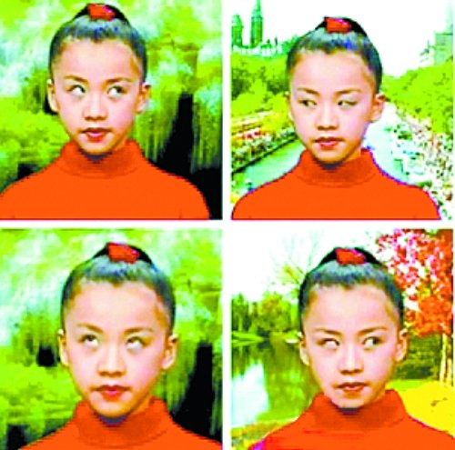 新型眼保健操走红 医生:“翻白眼护眼”不靠谱