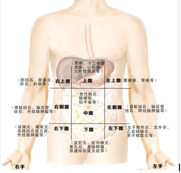 急性腹疼的鉴别与急救措施