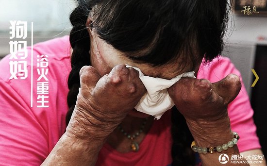 “狗妈妈”感动万千网友 邀您一起看望流浪狗