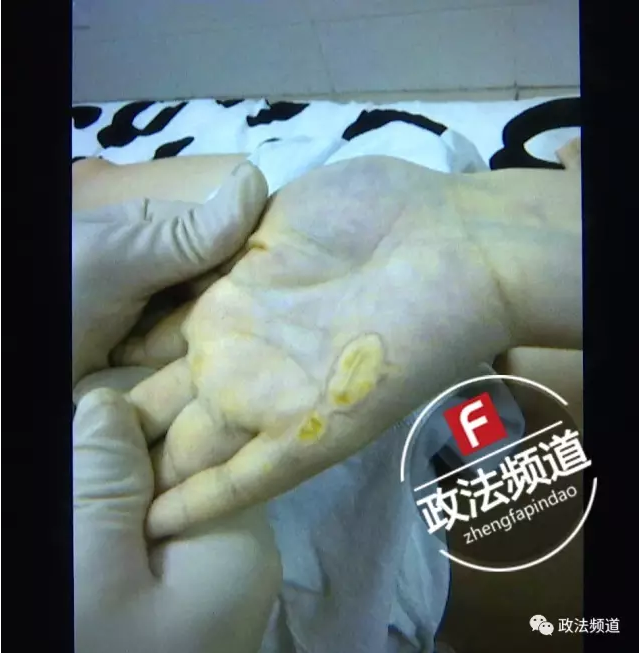 常德一女子洗澡时触电身亡 丈夫施救险遭电击