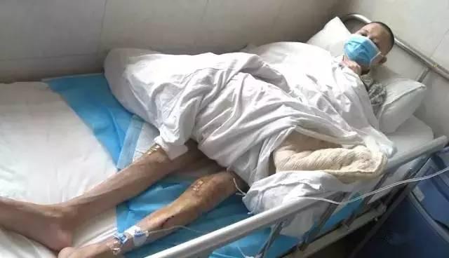 浏阳酒瘾男子20年酒龄 身高1米78体重仅88斤 