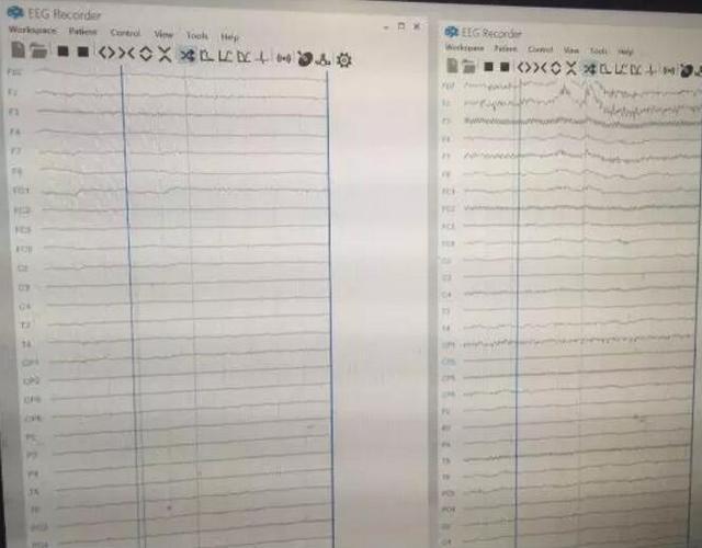 能力素质的测定,包括手眼协调能力,肢体反应,听觉处理等各项指标测试