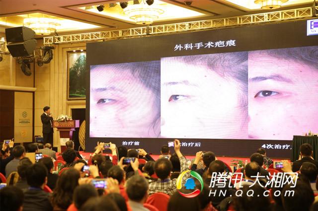 2015湖南省医学美容学术年会在长沙盛大召开