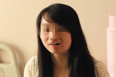 湖南妙龄女子患罕见怪病成"半脸女孩"(图)---郴州孕妇