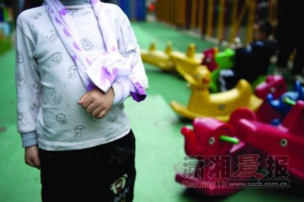 12月12日,雨花区圭塘小区简易幼儿园,浩浩的左手因为骨折打了石膏.