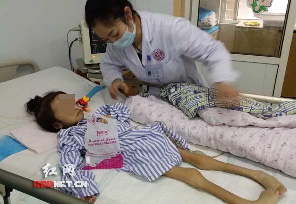 6岁女童患怪病体重仅有8公斤 皮包骨头令人震