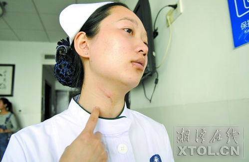 病人突发狂躁症打人 湘潭护士无惧拳头仍帮止