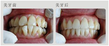 【好牙依口腔】20年口腔连锁品牌