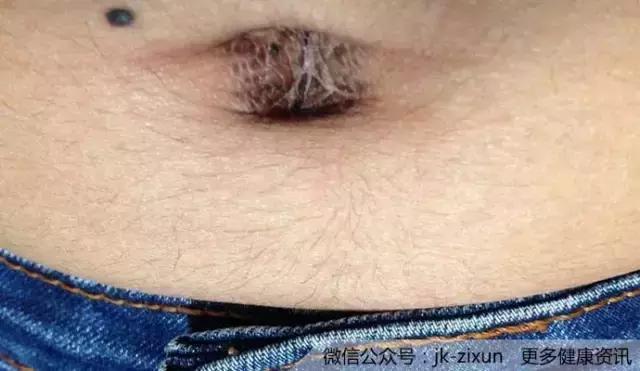 你抠过肚脐眼吗?是时候揭开真面目了!