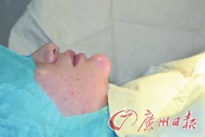 湘籍女子误信损友打美容针 下巴长肿瘤似脚后跟