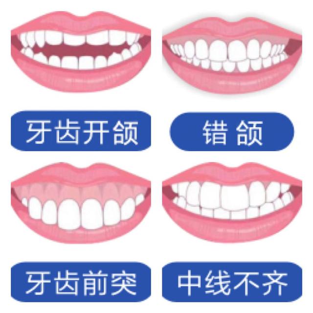别让一口牙毁了一张脸 全城招募免费牙齿矫正体验者