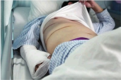 市民电梯里劝灭烟招横祸 “吸烟男”狂砍劝烟者