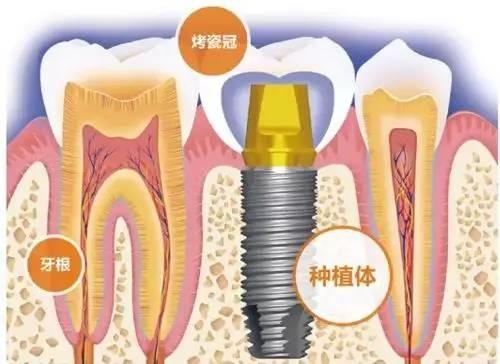 牙齿刷不白?看了这篇文章全明白!