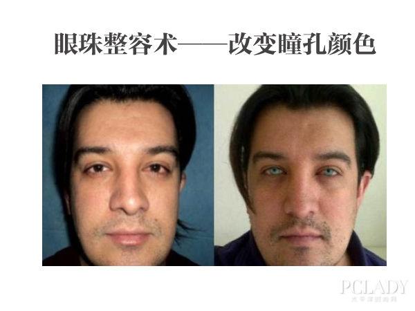 黑色眼珠戴什么美瞳好看,黑色眼珠戴什么美瞳好看图片
