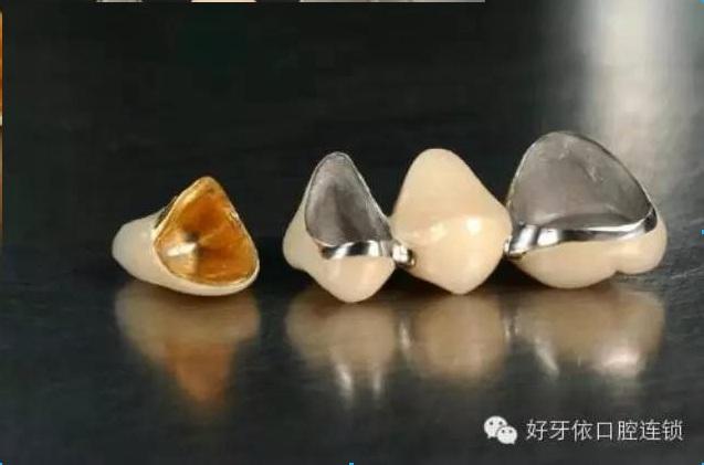 好牙依科普:烤瓷牙的危害