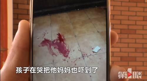 楼房外墙瓷砖脱落 5岁男孩被砸成重伤