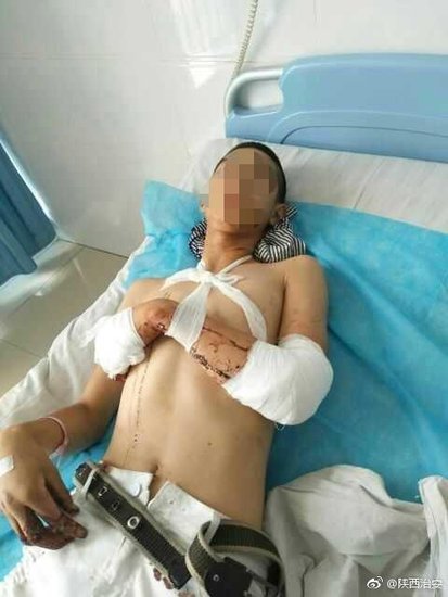 汉中一少年早恋 心生疑虑挥刀砍向“情敌”