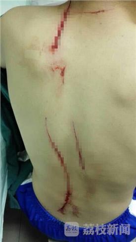 南京一名初一学生用裁纸刀划伤同学 伤口缝50余针