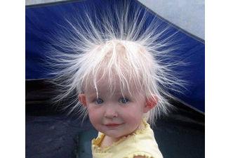 生活:10个小妙招解决静电烦恼