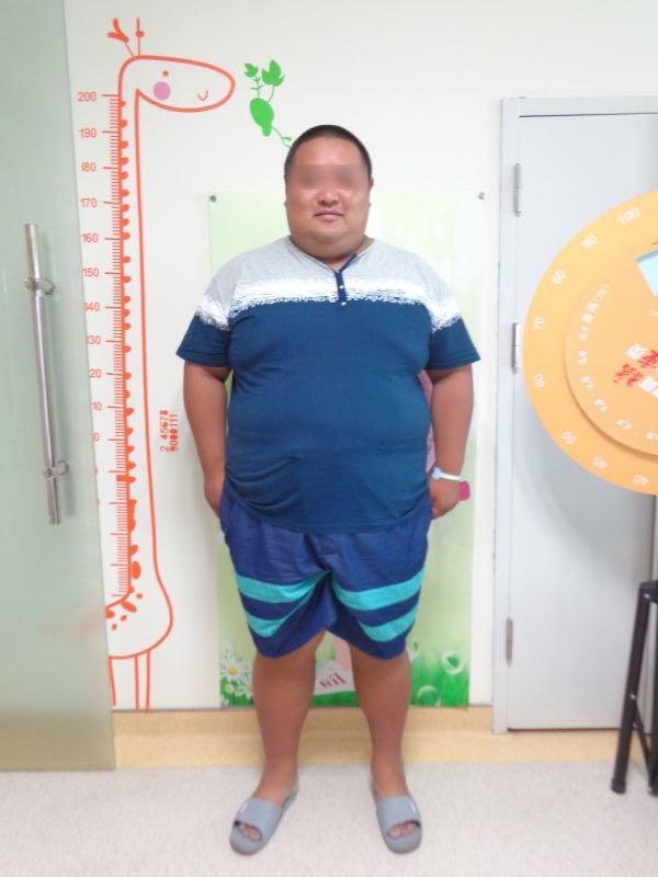 胖哥一年内成功减重160斤变型男