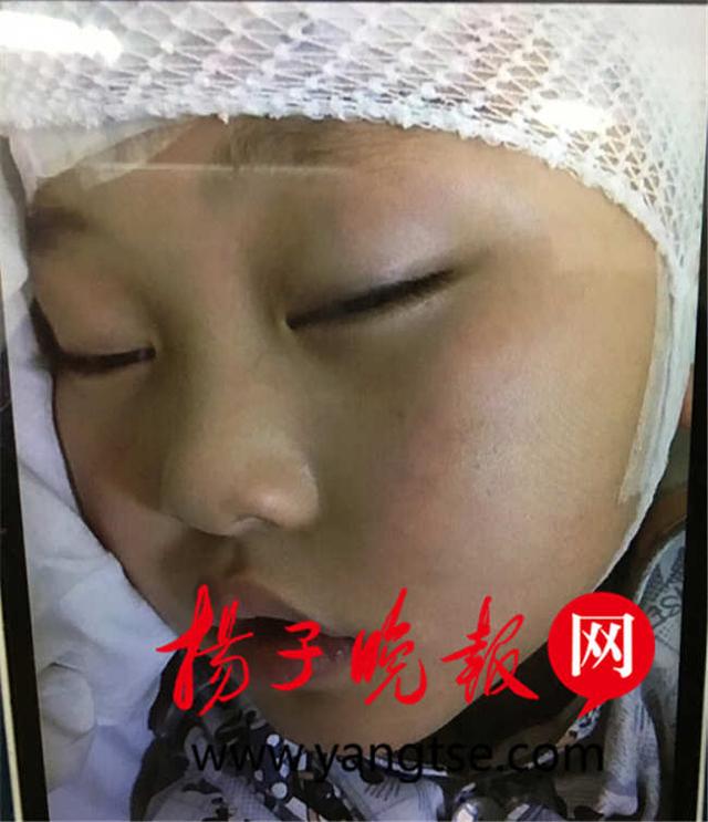 扬州一男童两个月抽搐几百次 得