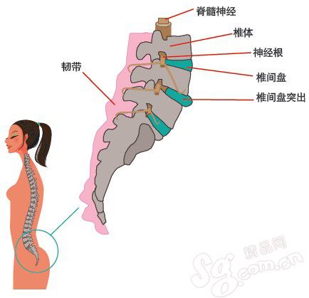 都市女性 别让腰椎太受伤(图)