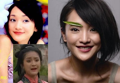 靠打瘦脸针的包子脸女明星