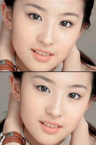 韩式双眼皮 轻松变靓眼美女