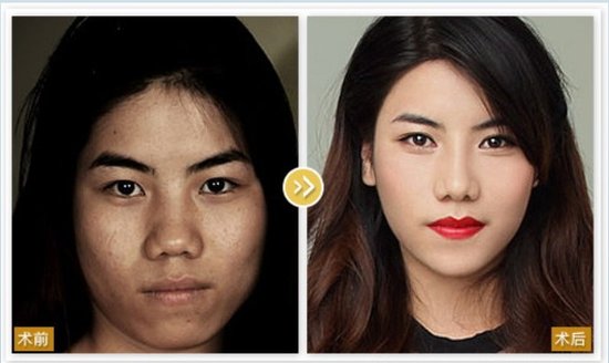 双胞胎<em>姐妹花</em>亲身验证神奇美鼻变脸<em>魔法</em>_米