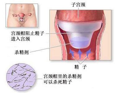 全面目击女人避孕全过程(图)_女性_腾讯网