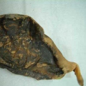 8款鲜为人知的中医养颜秘方